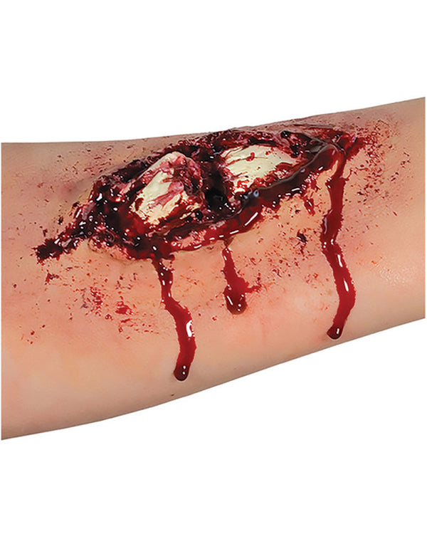 Broken Bone Latex Application