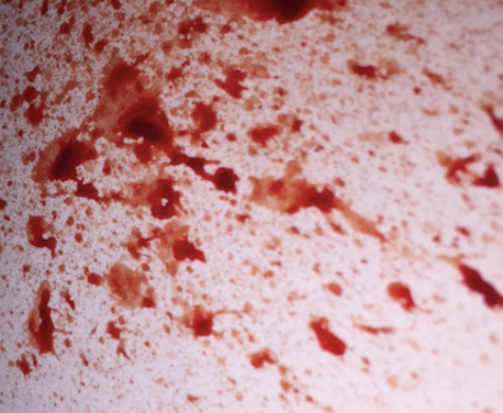 Blood Splatter Spray