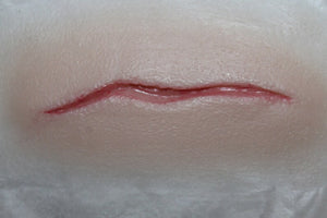 Small Thin Scar Wound Prosthetic
