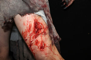 Outdoor Injuries Prosthetic Bundle