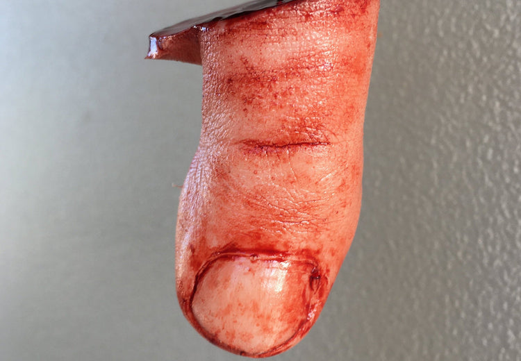 Severed Toe Prop